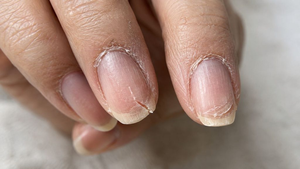 Healthy strong natural nails after proper care: overuse nail strengthener